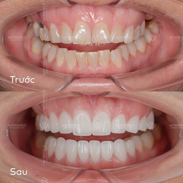 Slider image (7) WinSmile Dental Clinic Vietnam